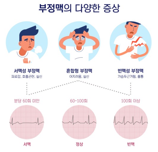 부정맥 증상: 핵심 체크 포인트와 상담 기준 완벽 정리