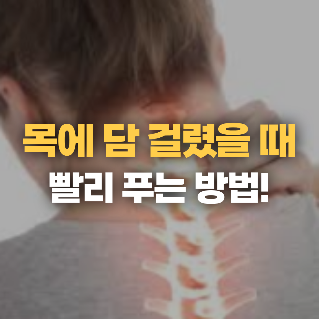 담 걸렸을 때: 최신 정보와 확인 포인트 완벽 정리