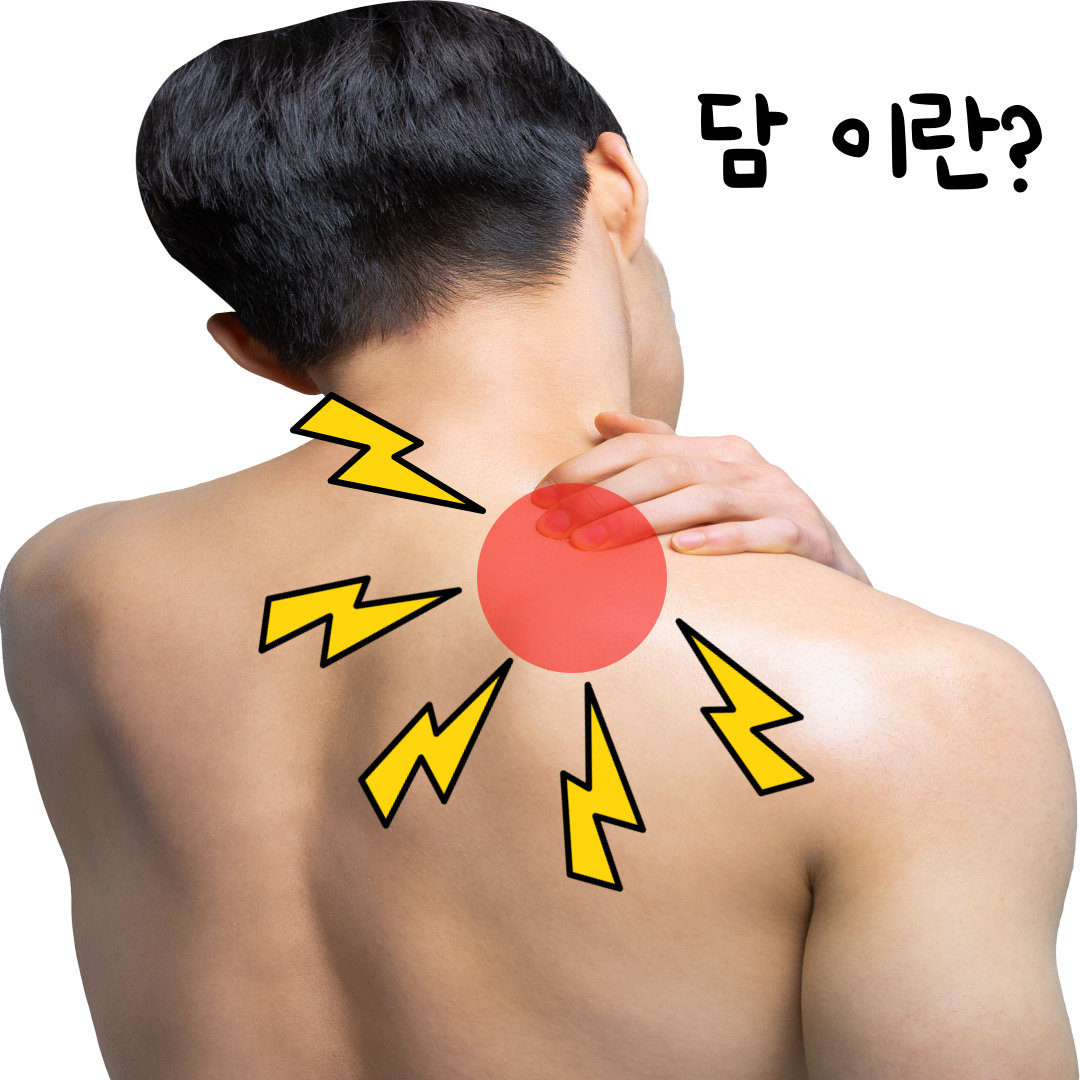 목에 담 걸렸을 때 어떻게 해야 하나요? 관련 이미지