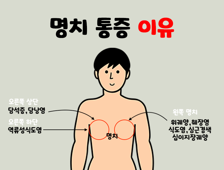 명치 통증, 핵심 체크 포인트와 상담 기준 완벽 정리
