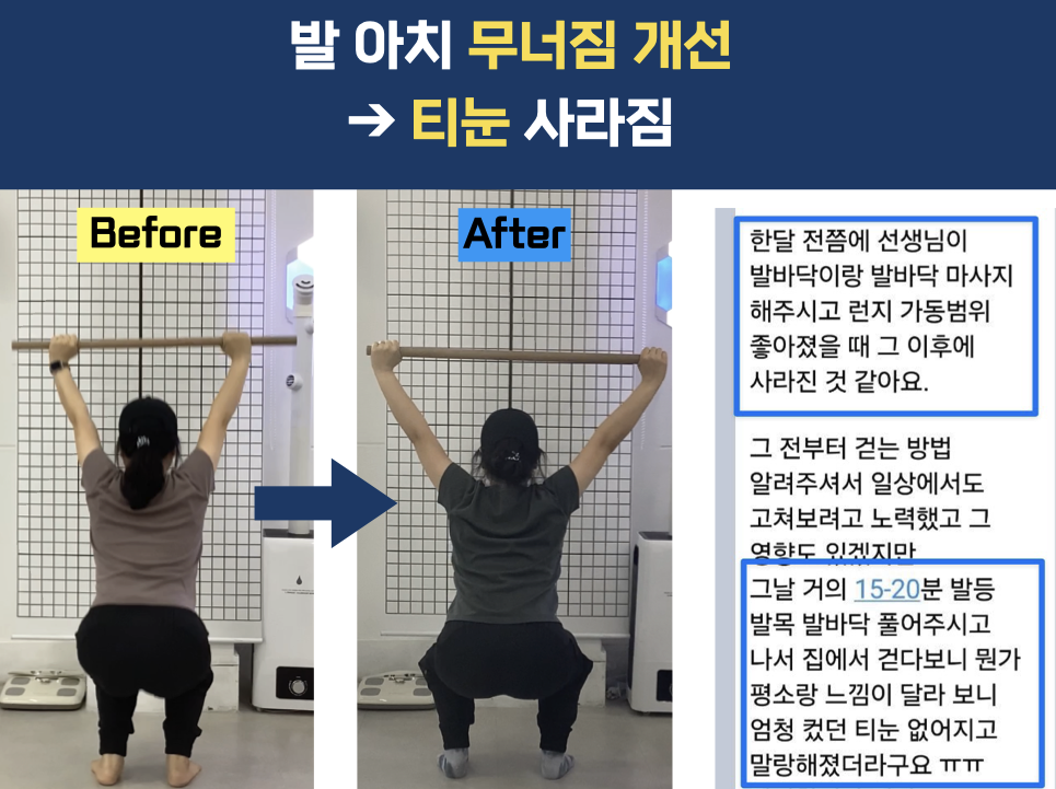 거북목 심한데 숙대 헬스장 다녀도 괜찮을까요? 관련 이미지